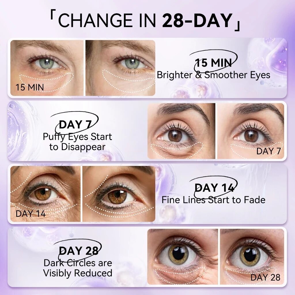 LANBENA 레티놀 안티 링클 아이 마스크 모이스춰  - Microneedle Patch Eye 리뷰 및 가격