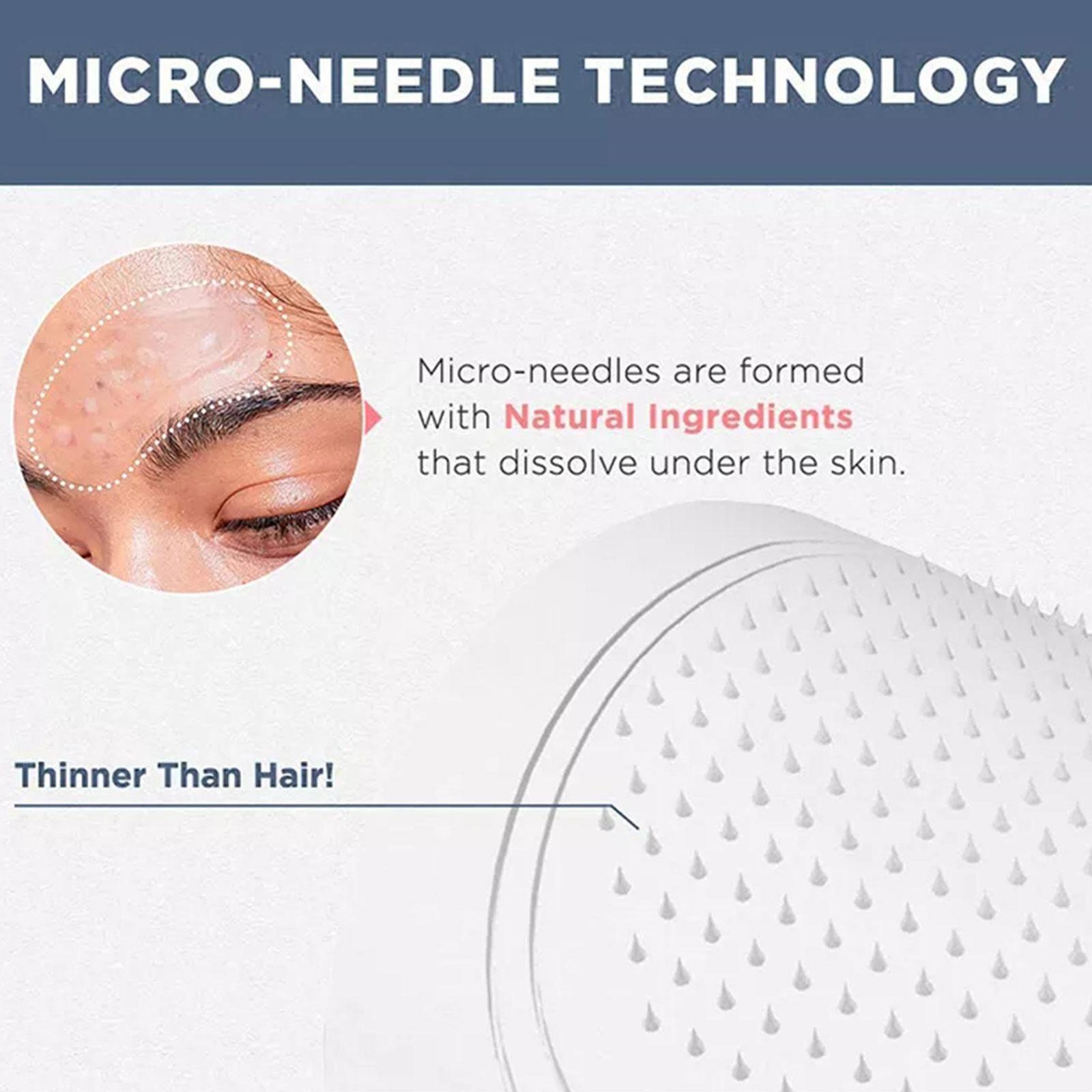 히알루론산과 콜라겐이 함유된 0.2mm 마이크로 니들  - Microneedle Patch Eye 리뷰 및 가격