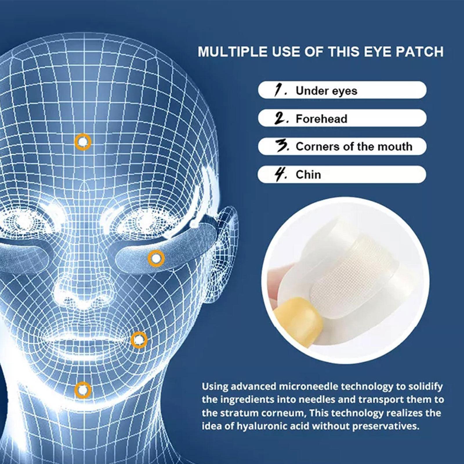 1 쌍의 히알루 론산 마이크로 니들 아이 패치 주름 방 - Microneedle Patch Eye 리뷰 및 가격